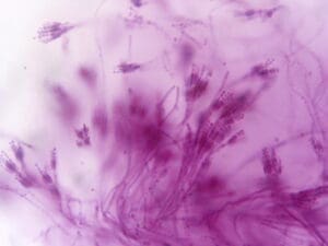 Penicillium Mold filtered